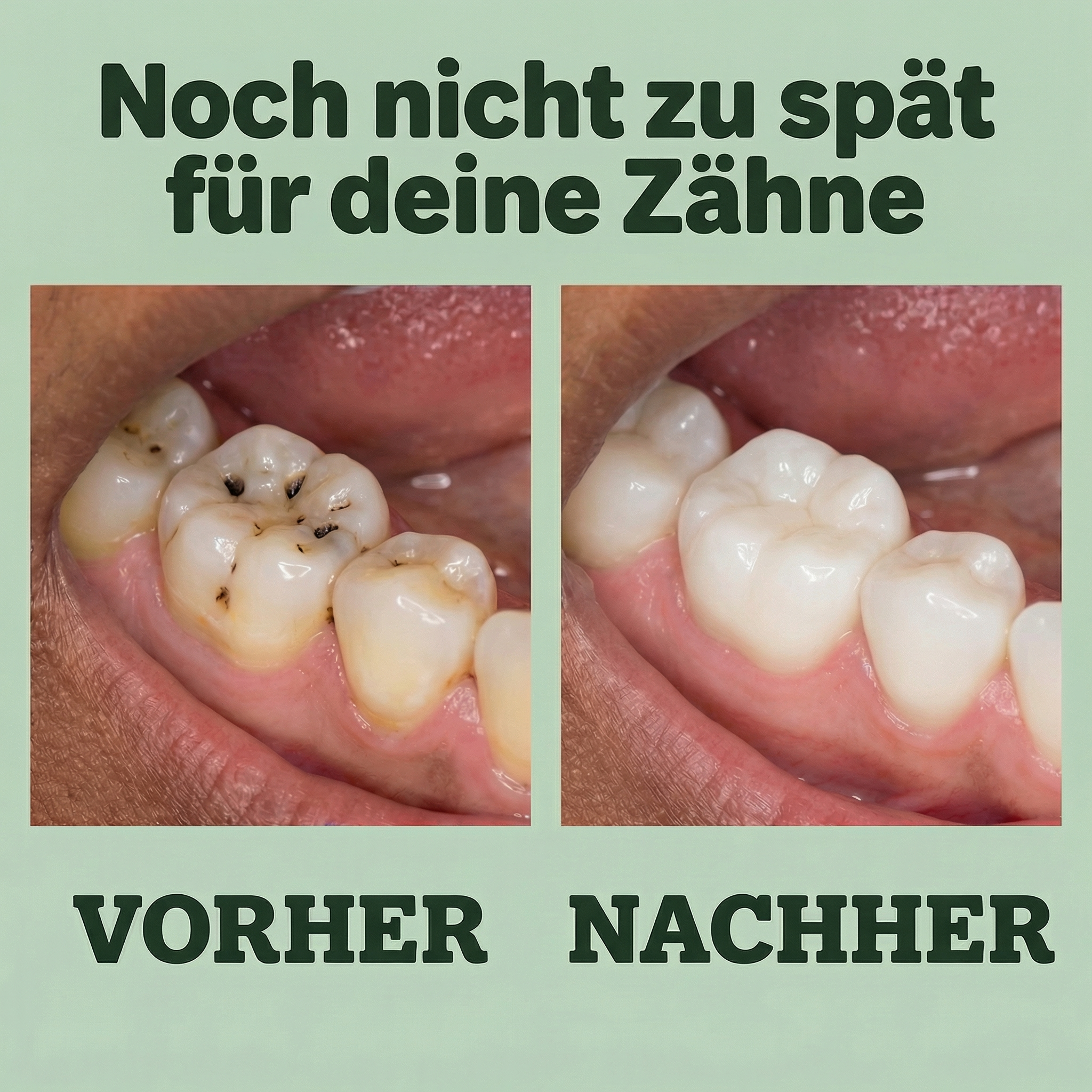Waldecht – Remineralisierender Kaugummi